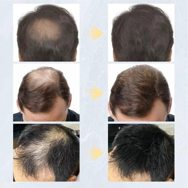 HairKer - Fibres Capillaires - HairKer